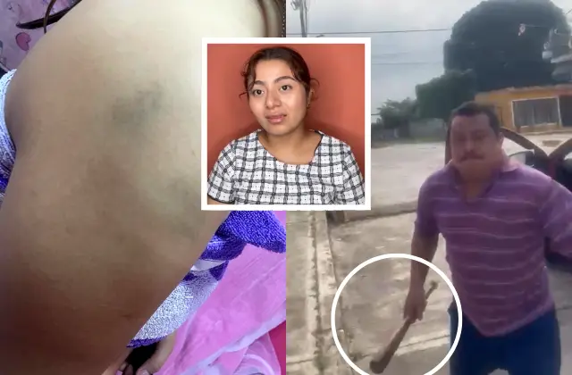 Fanny denuncia a su padre en Soconusco por golpearla con bat