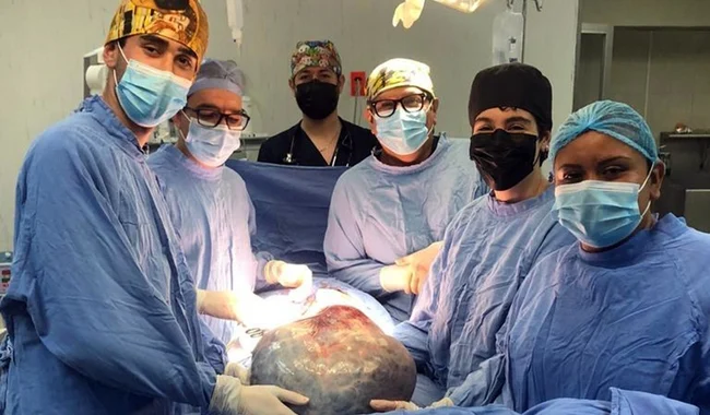 A una mujer le quitan un tumor gigante de 21 kilos en el IMSS de León