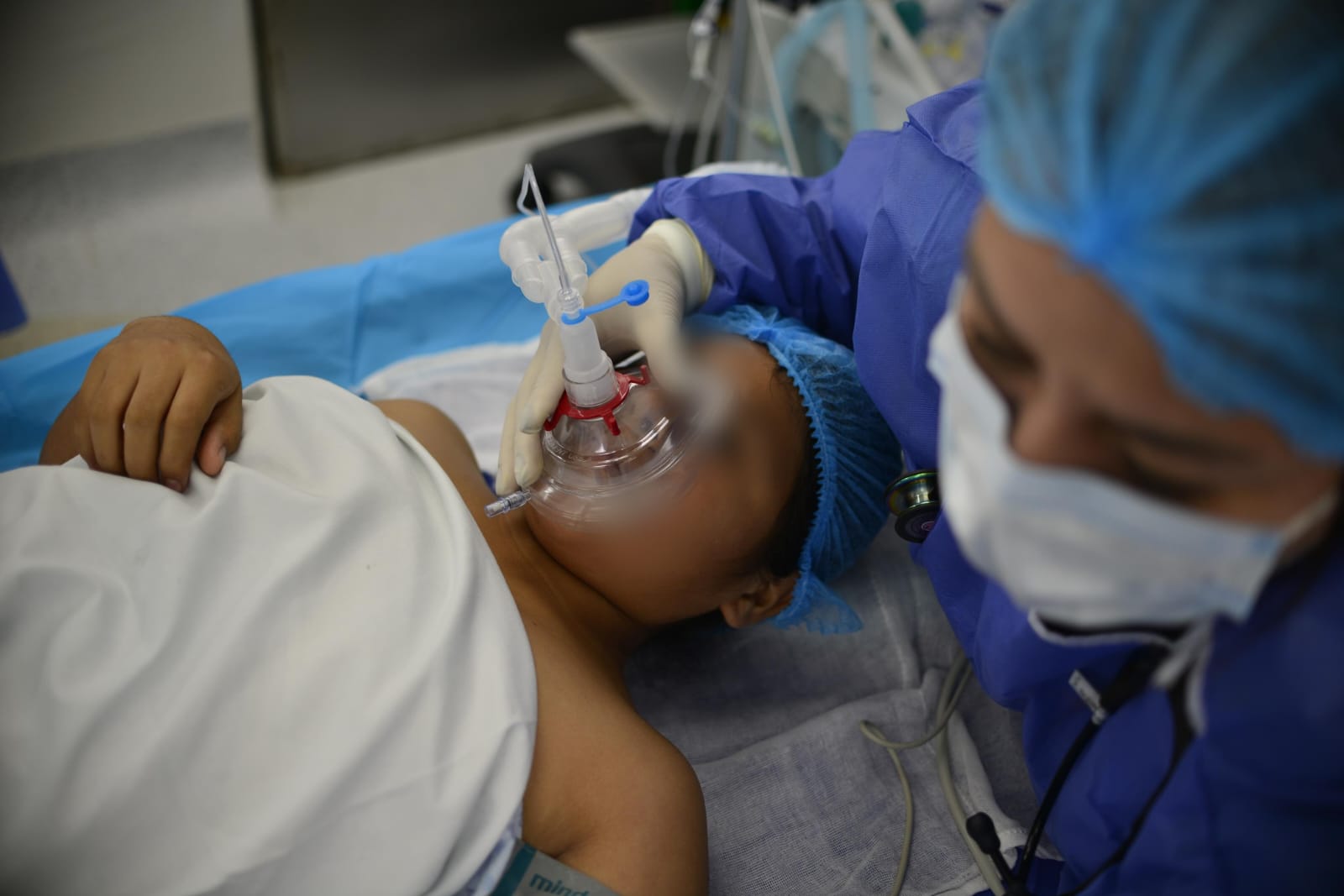 Salud Veracruz reactiva programa de cirugías para niños con quemaduras graves