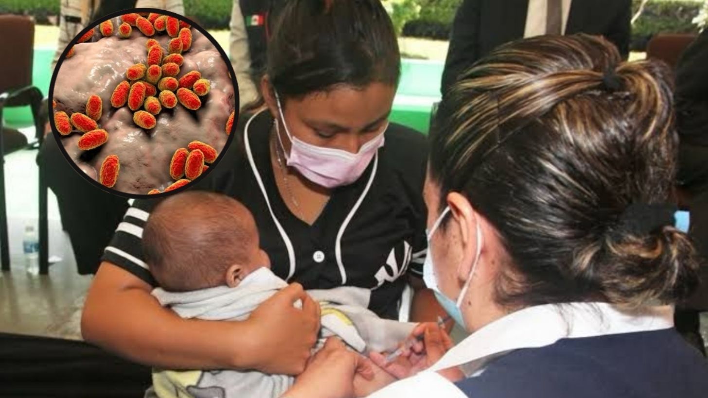 Se disparan casos de tos ferina en Chihuahua con 85 pacientes confirmados