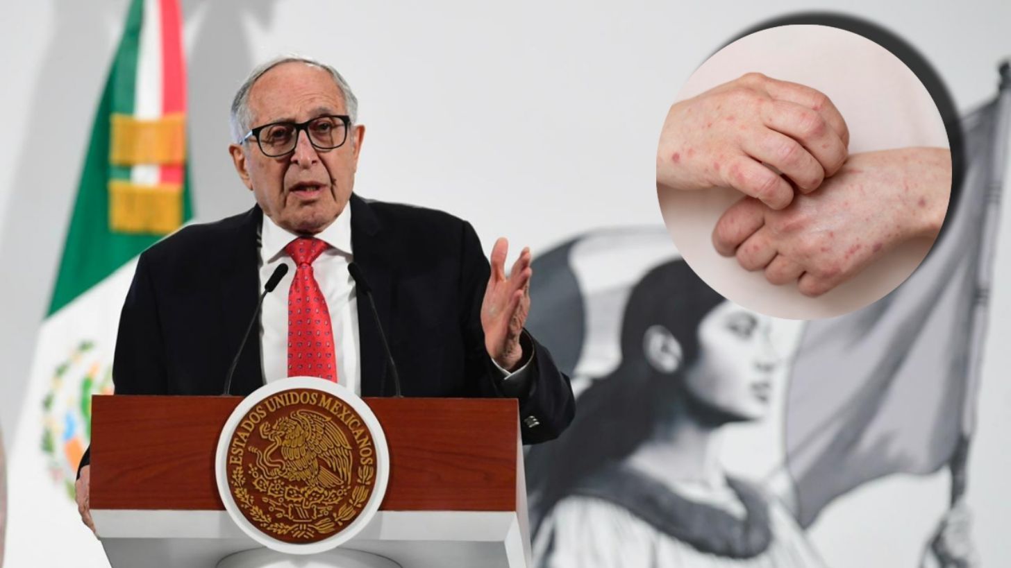 Prevé Secretaría de Salud que brote de sarampión termine en noviembre