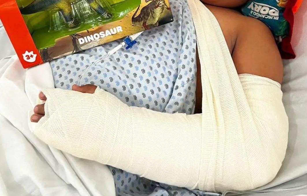 “Hay muchos niños quemados” por anafres y fogones en el sur de Veracruz