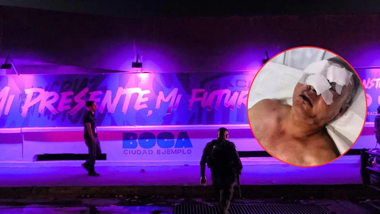 Aficionado del Celaya, en riesgo de perder vista tras riña en Boca