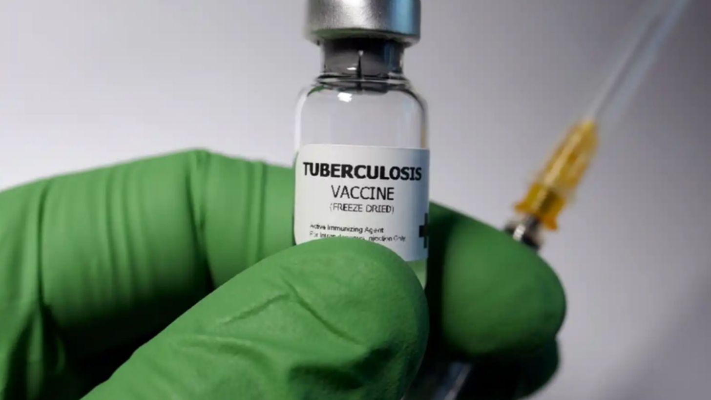 Chiapas en alerta por la tuberculosis respiratoria: reportan más de 100 casos en la entidad