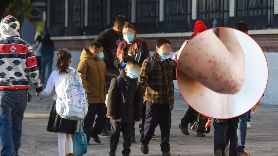 Sarampión Veracruz: escuelas de las Altas Montañas piden uso de cubrebocas por aumento de casos