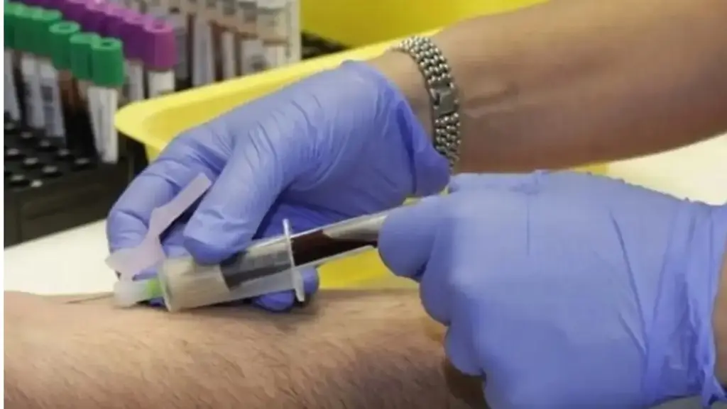 Un nuevo método avanza hacia la detección del cáncer con un análisis de sangre, según estudio