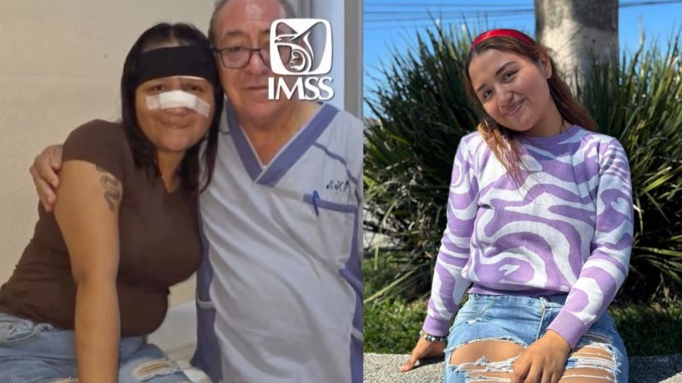 Tras accidente en Martínez, realizan reconstrucción total del rostro de Katia en el IMSS Veracruz