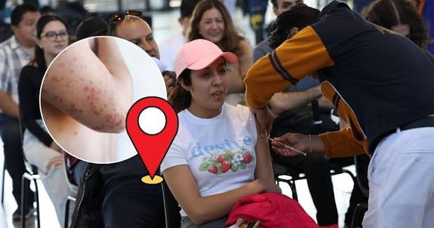 Autoridades valoran ampliar campaña de vacunación contra sarampión tras brote en Xalapa